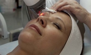 göz çevresindeki cildi gençleştirmek için Blefaroplasti